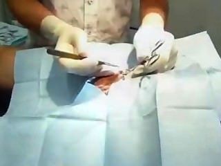 Австралийское вазэктомии на неподрезанные самца - преп, бриться, обучение ленты